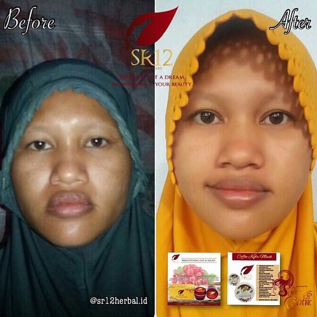 CREAM PENCERAH BPOM AMAN / KRIM SPF BRIGHTENING DAY &amp; NIGHT SR12 / MENYAMARKAN NODA HITAM