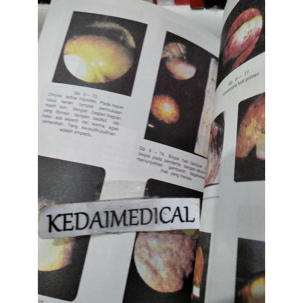 BUKU GASTROENTEROLOGI SUJONO HADI FULLCOLOUR TERMURAH