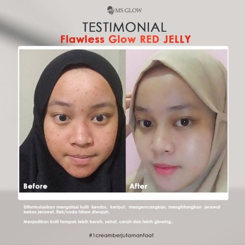 (Original 100%) Ms Glow Red Jelly / Red Jelly MS Glow Beauty