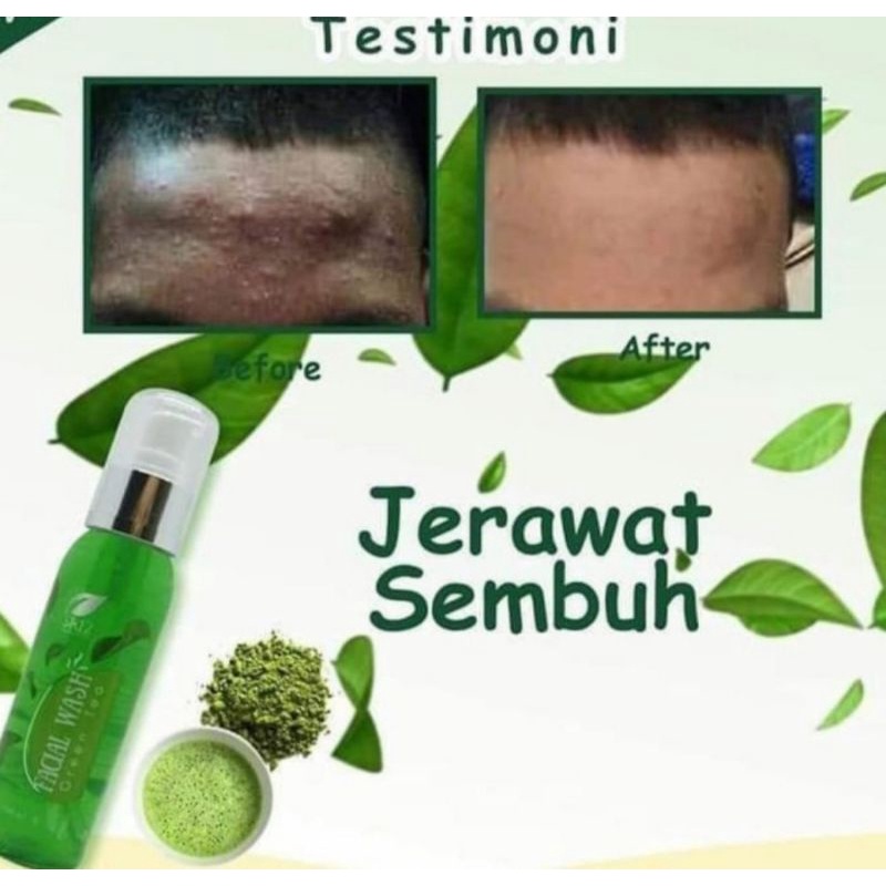 SABUN JERAWAT Facial Wash Green Tea SR12 Herbal Skincare Mengatasi Jerawat SABUN cuci muka pembersih wajah