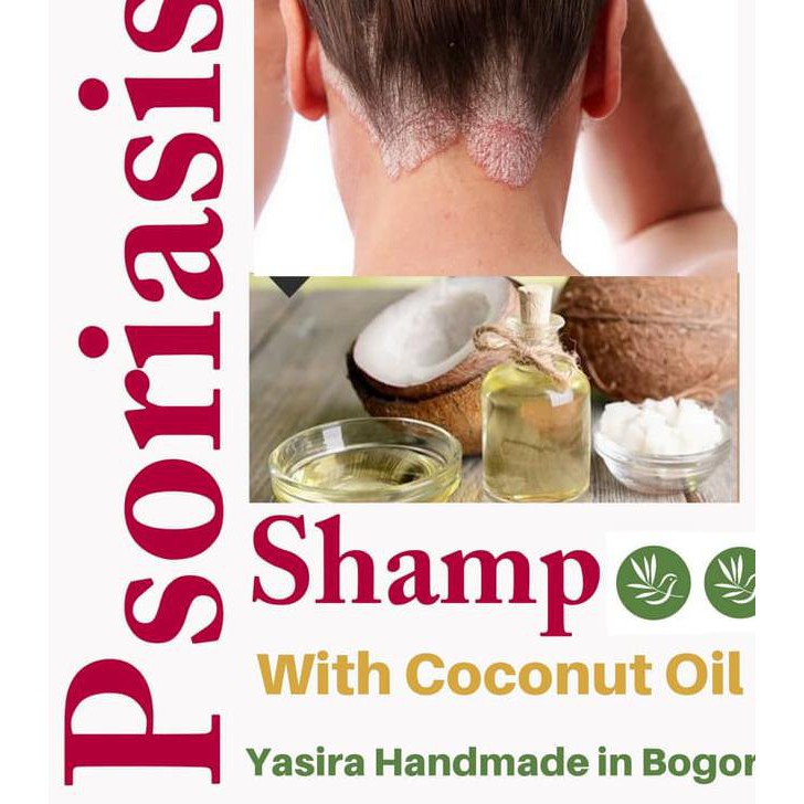 BEST DEAL HOMEMADE NATURAL PSORIASIS SHAMPOO 250 ML