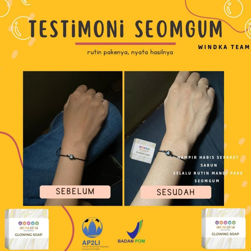 SeomGum ungu/kuning