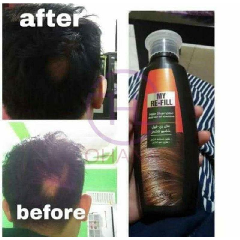 Re-Fill Shampoo anti rontok MyWay