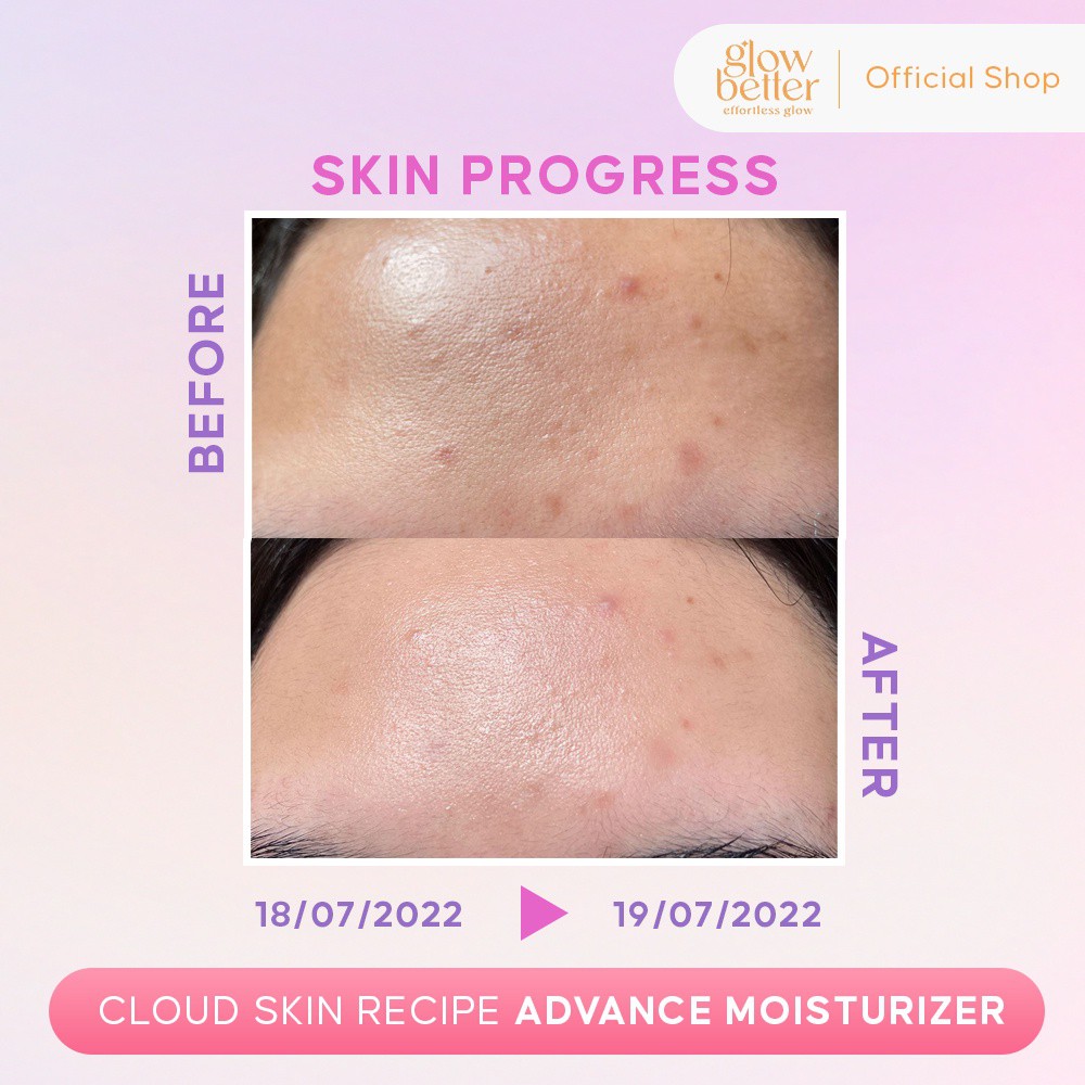 Effortless Glow Cloud Skin Recipe Advance Moisturizer (50 ml)