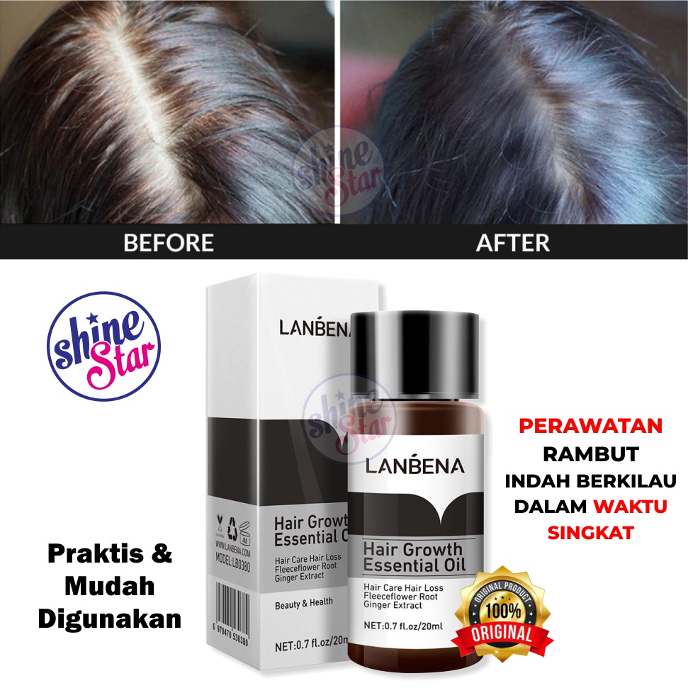 SHINE STAR - [ BISA COD ] Hair Growth Oil Serum Ampuh Menumbuhkan Rambut Botak &amp; Mencegah Kerontokan