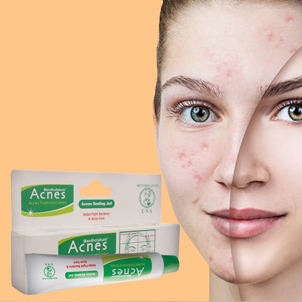 ✿ELYSABETHME✿ ACNES sealing jell gel untuk jerawat totol acne menghilangkan bekas flek