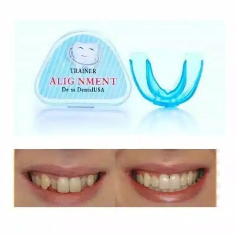 Perapi Gigi Tanpa Behel Original Bergaransi Teeth Trainer Alignment Original Asli