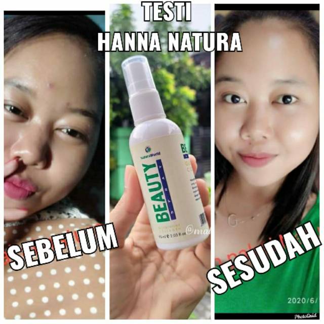 Natura World Beauty Spray (1paket)
