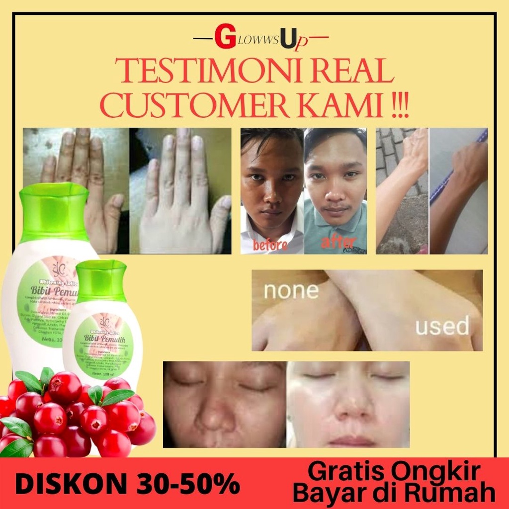 SYB Whitening Lotion Bibit Pemutih Badan Permanen - Body Whitening - Perawatan tubuh