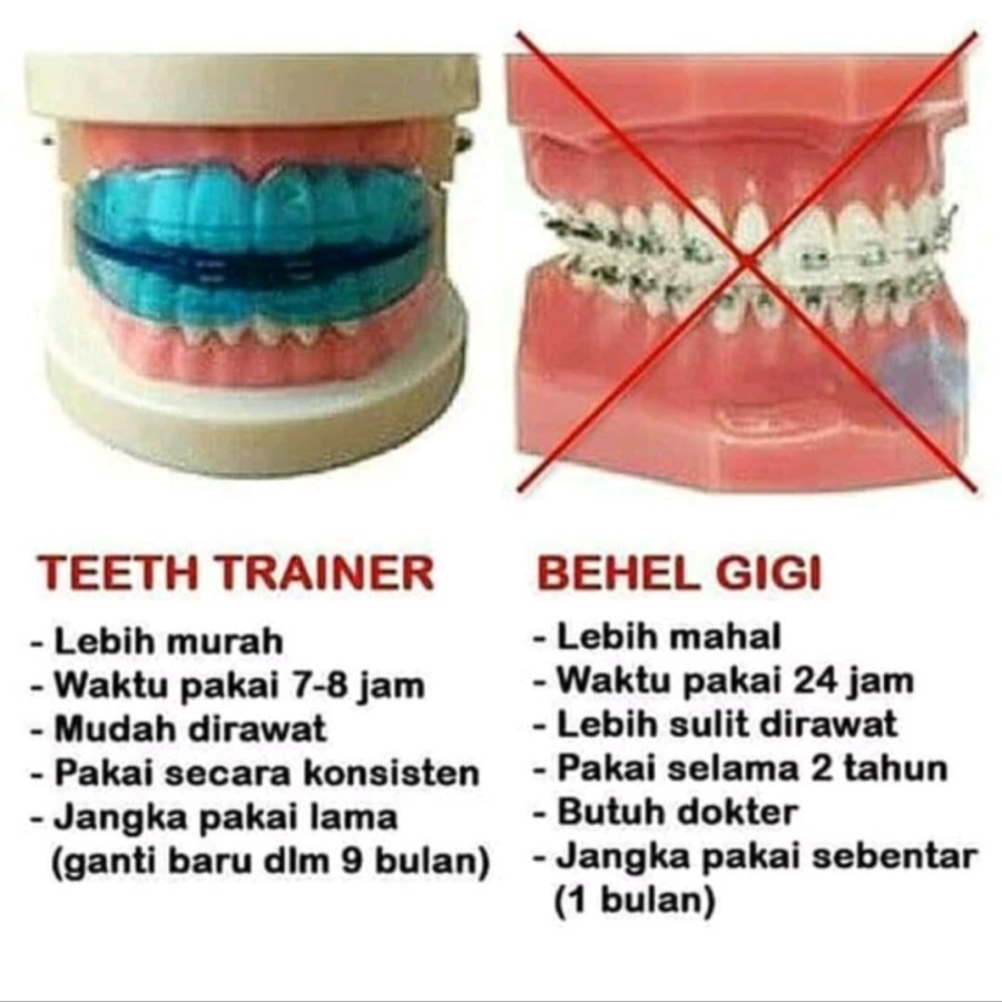 [CEV] Alat Perapi Perata Gigi Orthodontic Retainer Teeth Trainer Alignment