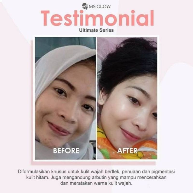 Paket Ultimate MS Glow paket wajah 100% original menghilangkan flek dan kerutan(bisacod)