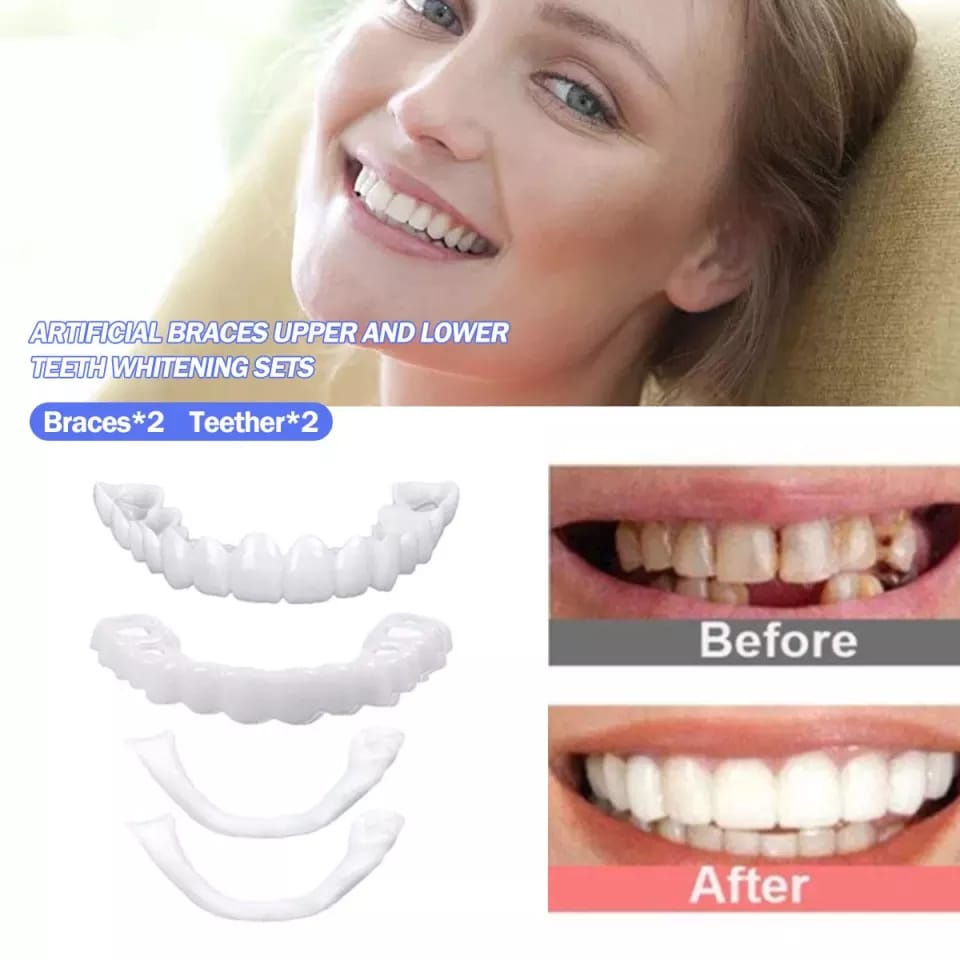 laristerus79 SNAP ON SMILE sepasang atas bawah veneer gigi palsu S009