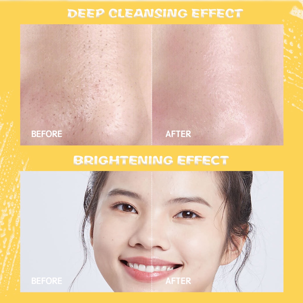 YOU Hy! Amino Glo-Win Brightening Facial Wash Sabun Cuci Muka