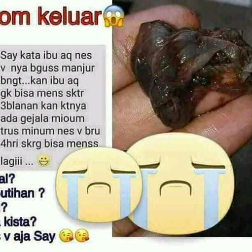 

T5D☆ PERAWATAN MISS V RAPET KEWANITAAN NES V HWI ORIGINAL 100% NESS V OBAT PERAPET PERAPAT MISS V Trend