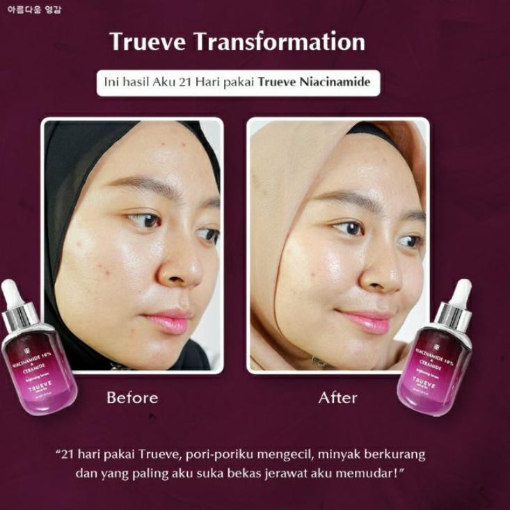 Termurah TRUEVE NIACINAMIDE 10% & CERAMIDE Brightening Serum