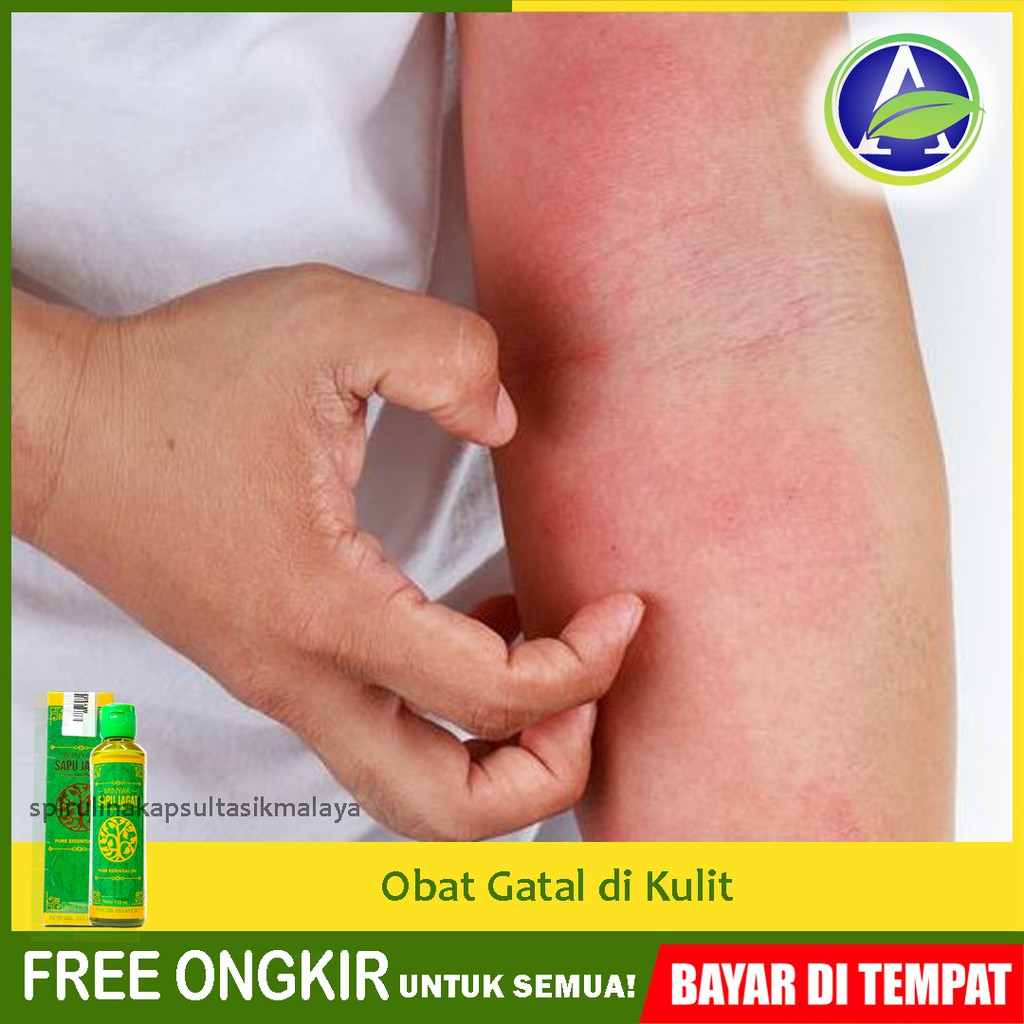 Obat Gosok Gatal Kulit Kudis Kurap Jamur Kulit Herbal Minyak Sapu Jagat Asli Halal Legal Bpom Shopee Indonesia
