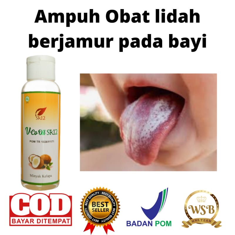 VCO OIL SR12 UNTUK LIDAH PUTIH  PADA BAYI
