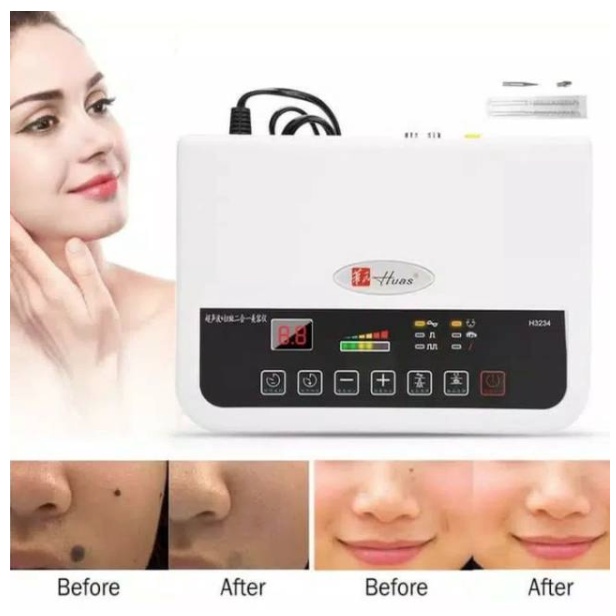 HUAS alat detox wajah ultrasound kantung mata 2 in 1 soft cauter laser penghilang flek kutil tai lalat