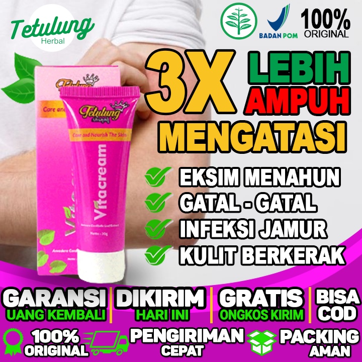 Salep Salep Untuk Eksim Salep Herbal Eksim Salep Eksim Gatal Salep Eksim Genital Salep Eksim Generik