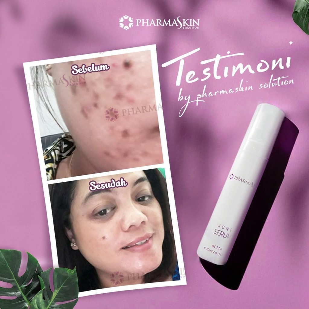 Pharmaskin Paket Full Treatment Acne Glowing Series Bebas Menghilangkan Jerawat Perawatan Wajah Berjerawat Glowing Ampuh Resmi BPOM Halal Original-5