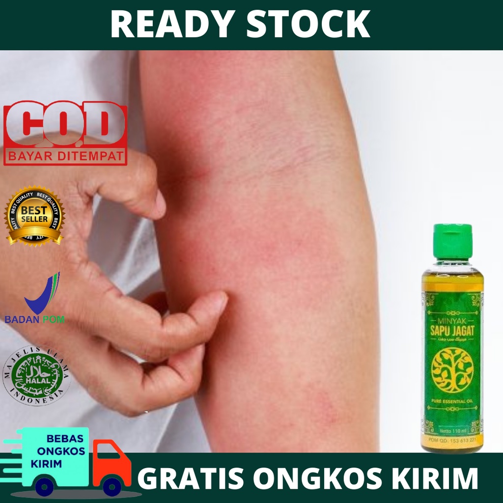 Obat Oles Gatal Akibat Jamur, Gatal Alergi, Alergi Kulit, Bintik Bintik Merah, Biduran, Kaligata