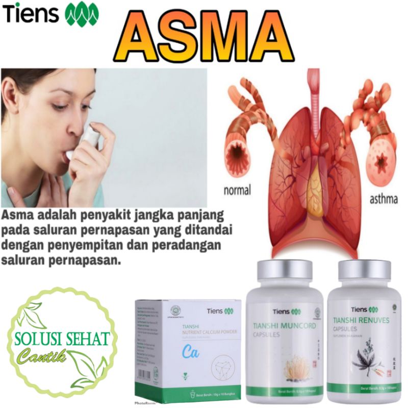 

Paket Asma Tiens / Obat Asma / Obat Sesak Nafas Herbal / Original (Kemasan Full)