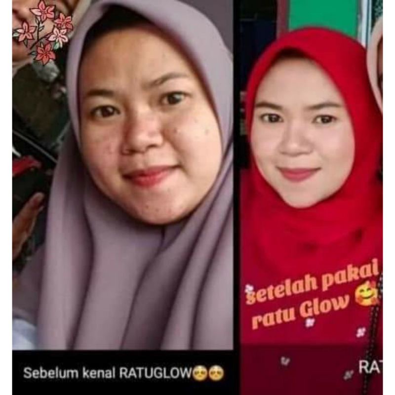 Ratu Glow Skincare Original BPOM paket acne brightening jerawat flek kusam Lo