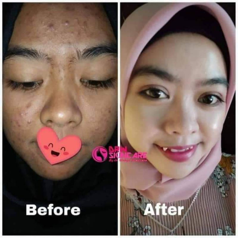 Paket Radiant Drw Skincare