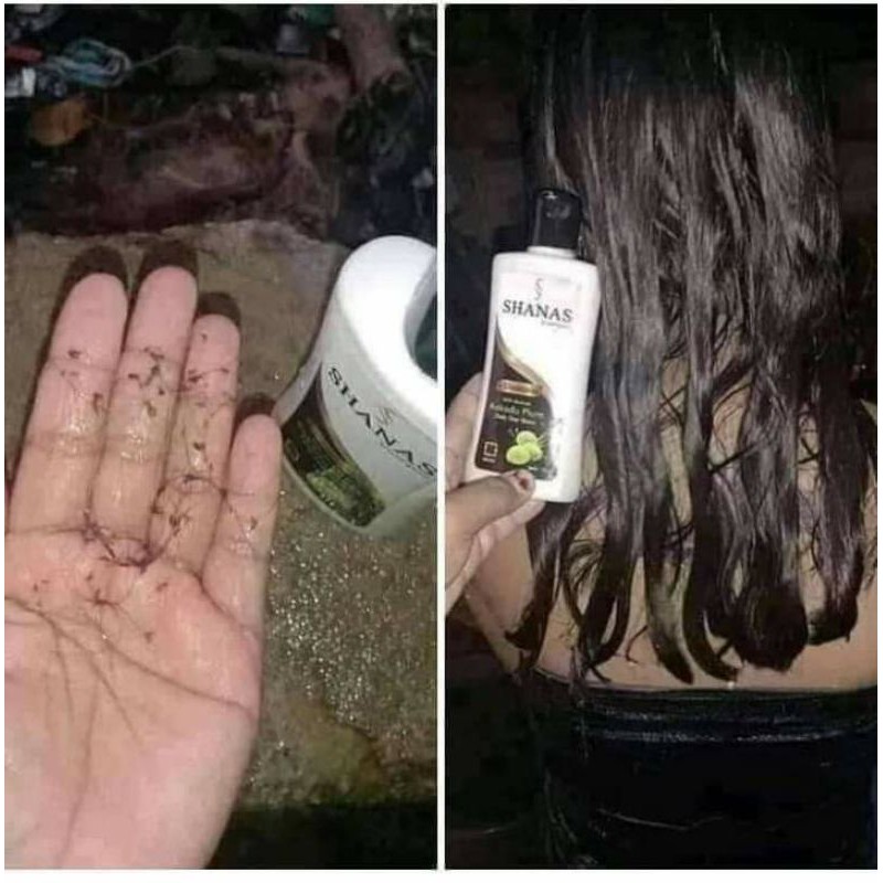 Sampo anti kutu 170 mil # SHANAS NASA