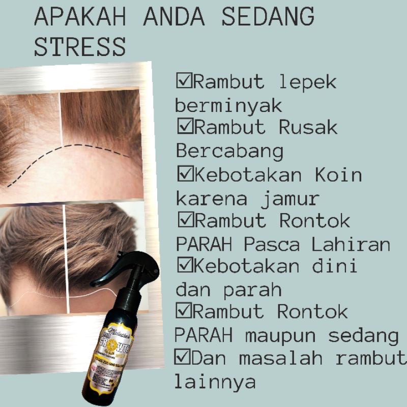 Serum Obat Penumbuh Rambut Botak dan Rontok Parah Malaikah Hair Growth