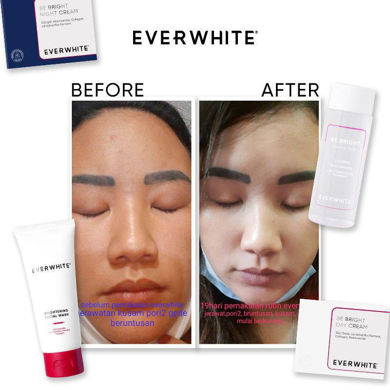 EVERWHITE BE BRIGHT! FACE SERIES/PAKET PERAWATAN WAJAH FACIAL WASH TONER DAY NIGHT CREAM ORIGINALl