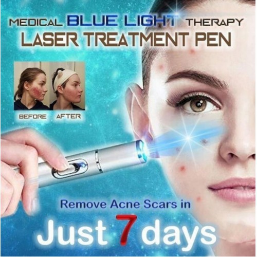 Pen LED Biru Laser Penghilang Jerawat Acne Treatment - KD-7910