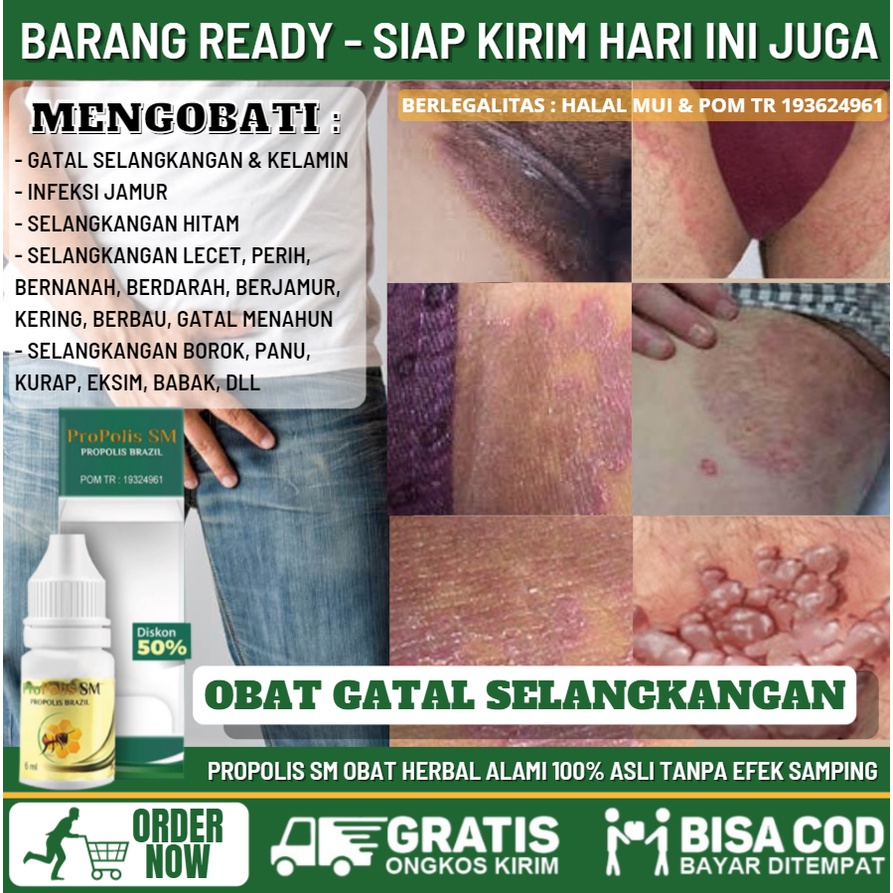 Obat Alami Selangkangan Gatal Lecet Kering Berjamur, Penghilang Selangkangan Hitam_Pekat, Obat Oles 
