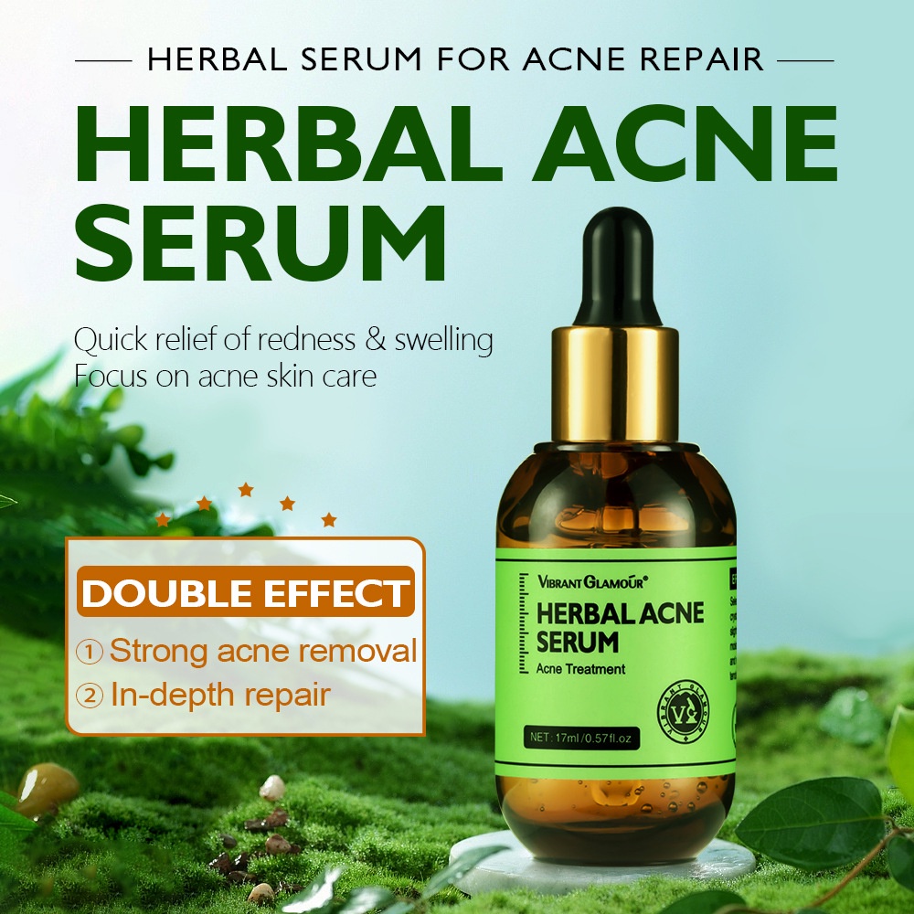 VIBRANT GLAMOUR Herbal Acne Treatment Cream / Acne Treatment Serum-Krim Perawatan Jerawat Tea Tree Oil penghilang jerawat Menghilangkan Pimple Dan Mengencangkan Pori-pori Kulit Berminyak Kulit Berjerawat