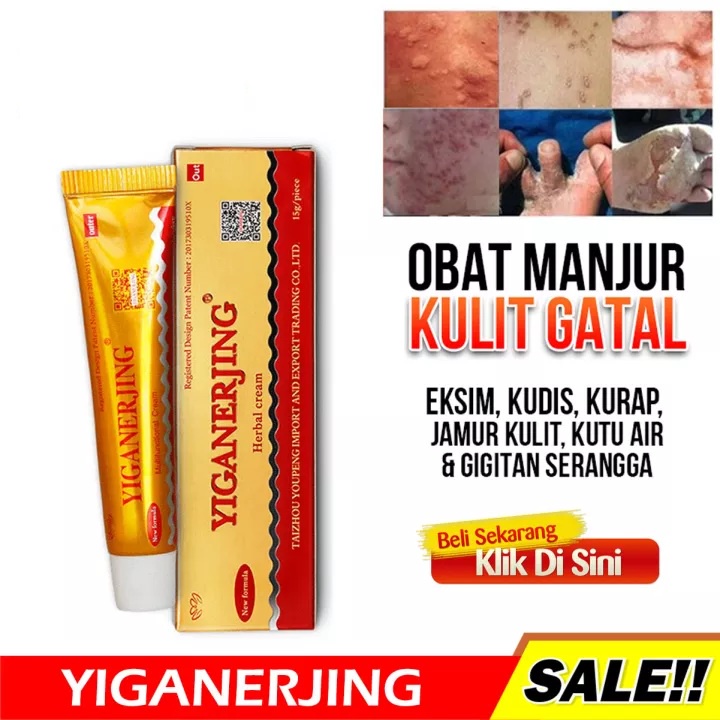 BEAUTY JAYA - Yiganerjing Obat Salep Dermatitis Eksim /Gatal Selangkangan Anti Jamur Kudis Kurap &amp; Gigitan Serangga