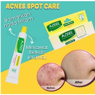 ACNES SPOT CARE OBAT JERAWAT &amp; BEKAS JERAWAT - 12GR