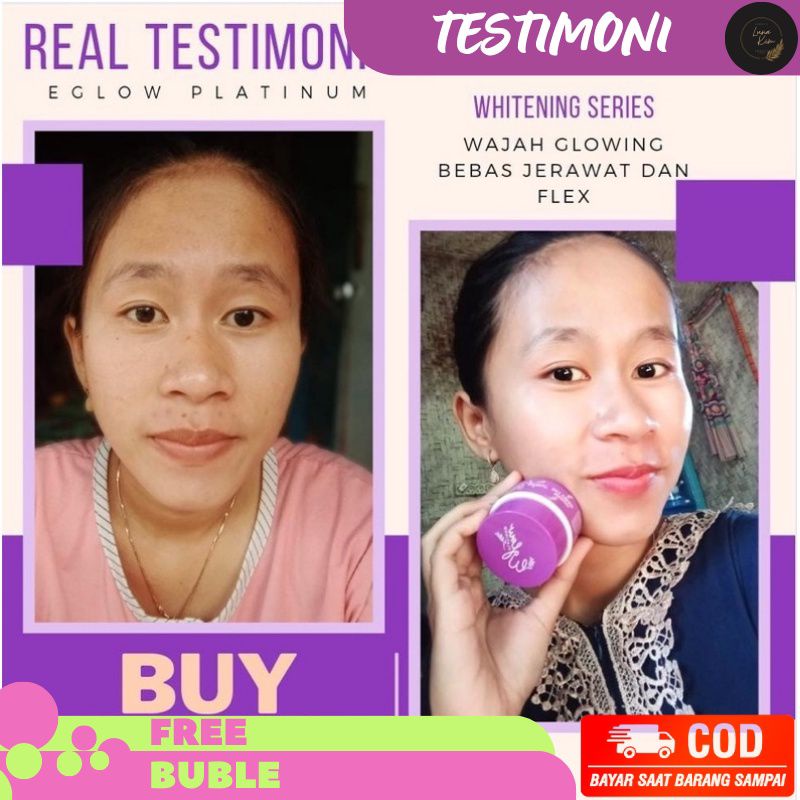 [ COD ] Eglow Platinum Ori Paket Pemutih wajah Eglow BPOM 100% ORIGINAL - Paket Wahitening Paket Acne