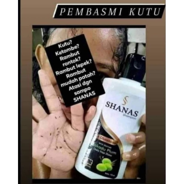 shampo shanas Nasa - SampoAntiKutu - PembersihKutu -  Pembersih Ketombe