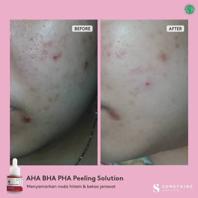 SOMETHINC AHA BHA PHA Peeling Solution 20ml