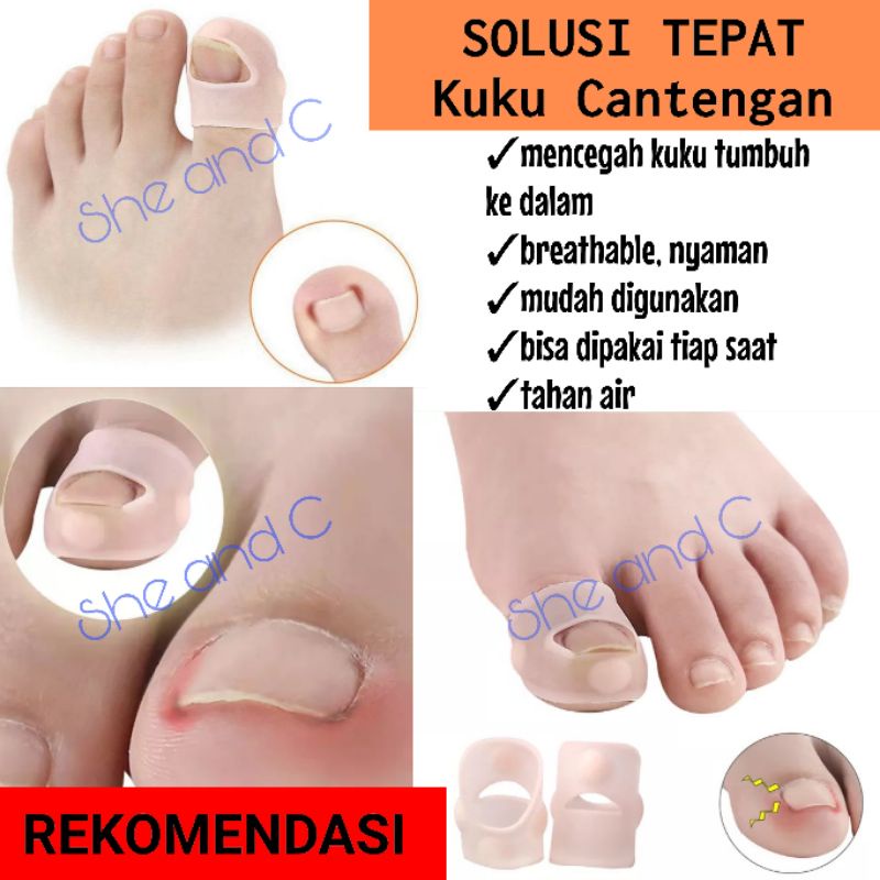 Anti Cantengan Alat Koreksi Kuku Kaki Tumbuh Ke Dalam Silikon Elastis Cantengan Cantengen Paronikia