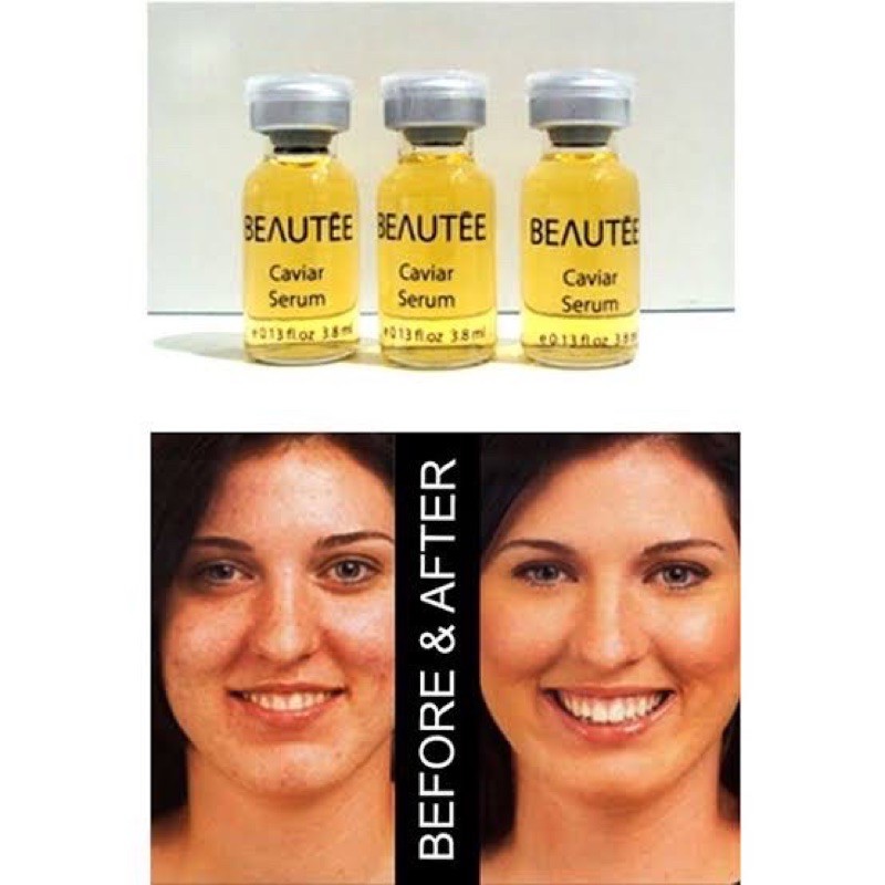 Beautee Nano Scar  Original Anti Parut Bopeng Bekas Scar 1box