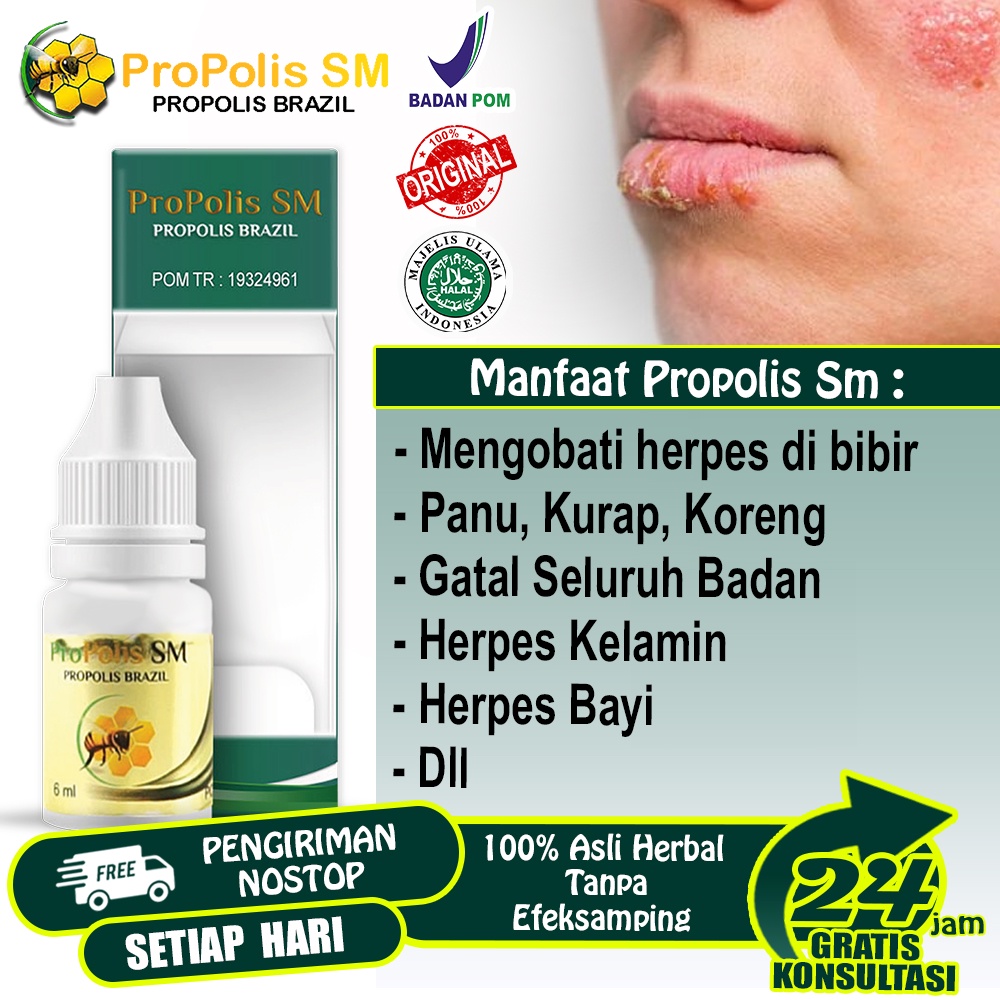 Obat Herpes Kelamin Salep Herpes Kulit Genital Herpes di Bibir Herpes Bayi Herpes Anak Penghilang He