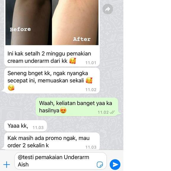 ➻ Aish C Bright Underarm Cream | Aish Serum | Aish Neck Brightening | C-Bright Serum dan Cream Untuk