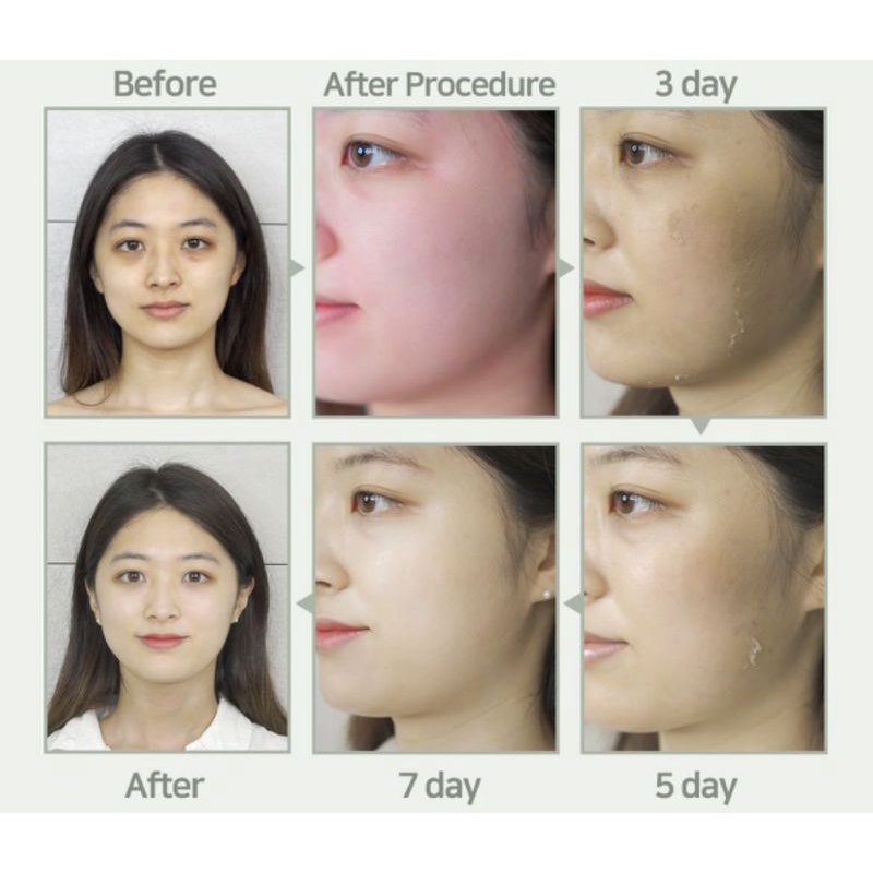 SEANERGY PEEL POWDER / PEELING WAJAH