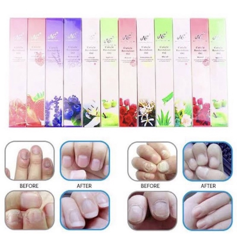 Vitamin Kuku Serum Cuticle Kuku Vitamin Kutikel Kuku Minyak Cuticle Oil serum