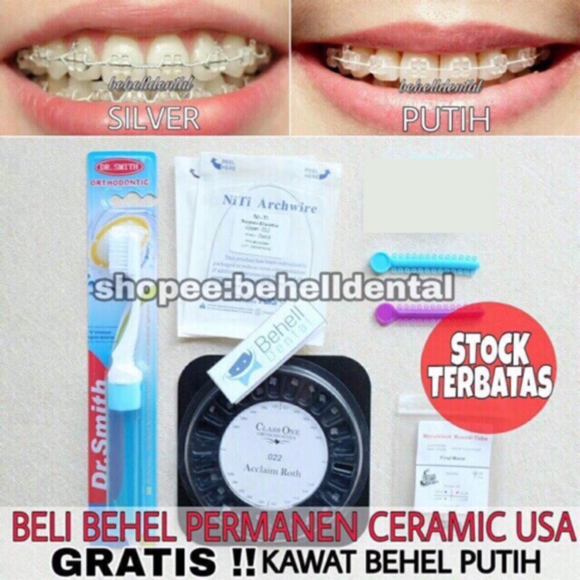 Paket Behel  Gigi Permanen Ceramic Classone USA sikat ortho 