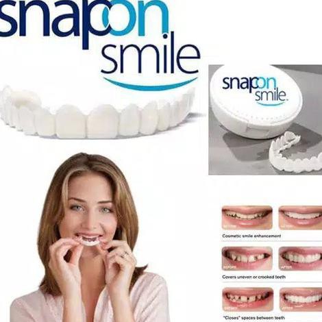 PROMO Gigi Palsu Snap on Smile Veneers Gigi Perfect Smile Gigi Tiruan