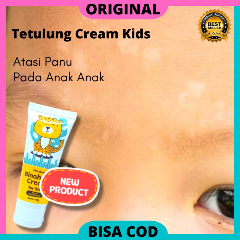 Jual Tetulung Binahong Cream Anak Salep Krim Antijamur Khusus Anak Bayi
