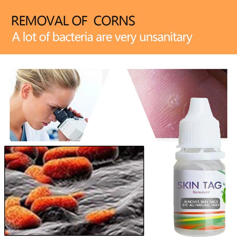SKIN TAG Penghilang Kutil dan Tahilalat Obat Kutil Obat Merontokan Kutil Kemaluan Penghilang 10ml