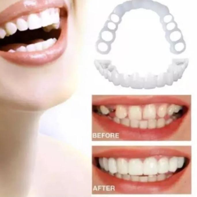 ✨SHOPEE MALL✨ Veneers original Satu Set Atas Bawah Gigi Palsu Snap on Smile murah